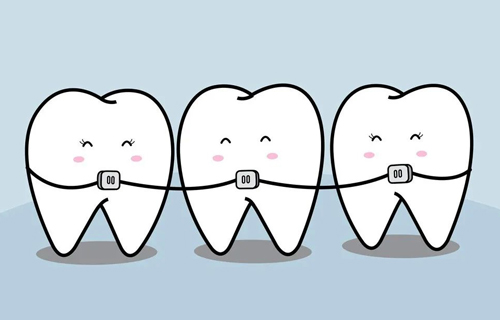 牙齿正畸，保持器如何选择？专家给你建议