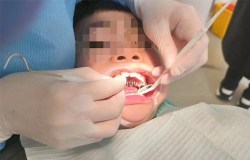 将乐趣融入矫治过程 儿牙专家帮男童重塑帅气颜值